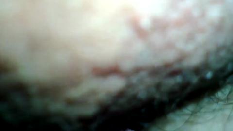 162